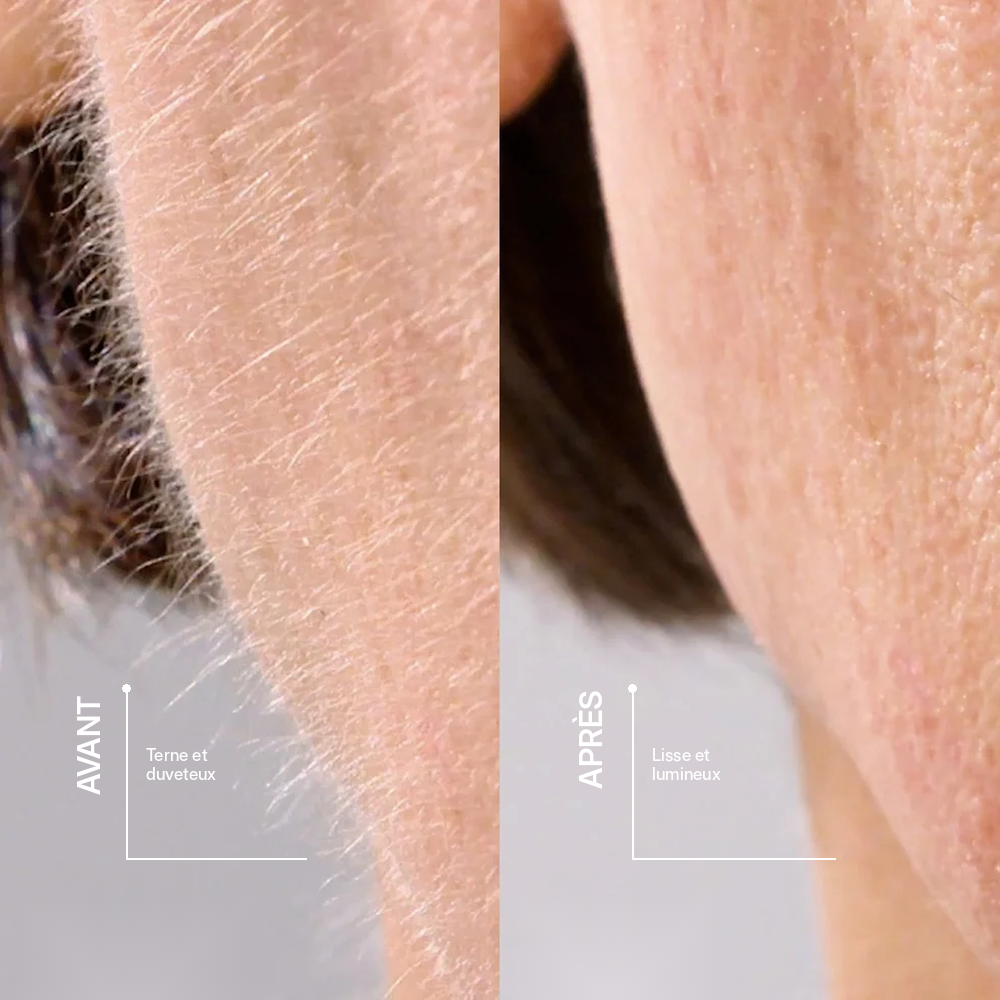 L'outil De Dermaplaning Velina Pour Femme