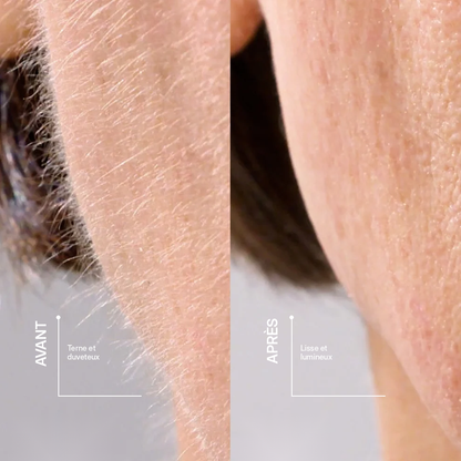 L'outil De Dermaplaning Velina Pour Femme