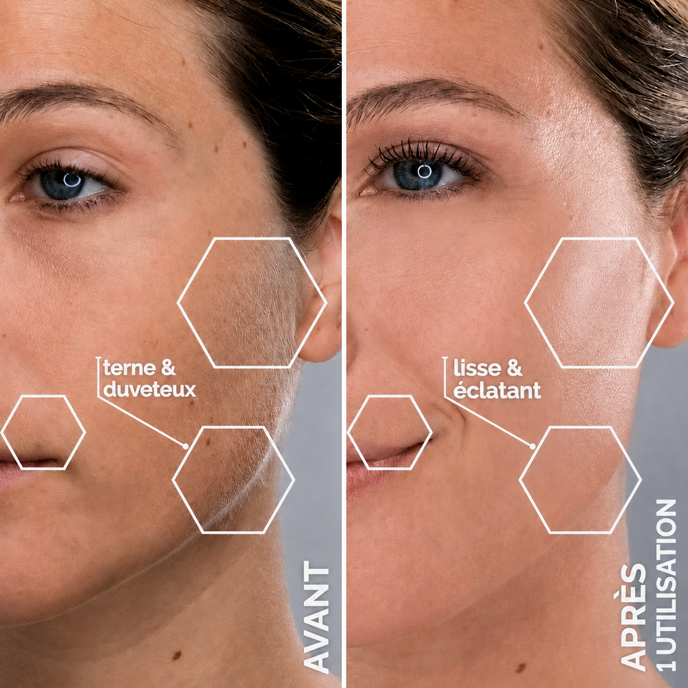 L'outil De Dermaplaning Velina Pour Femme